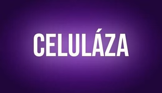 Celulaza